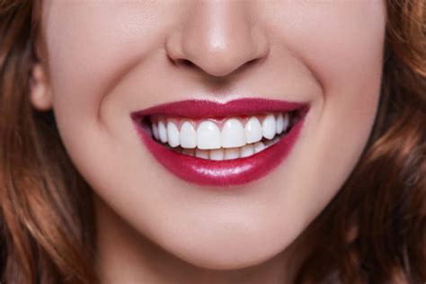 How Magic Teeth Braces Can Help You Achieve the Smile You Desire